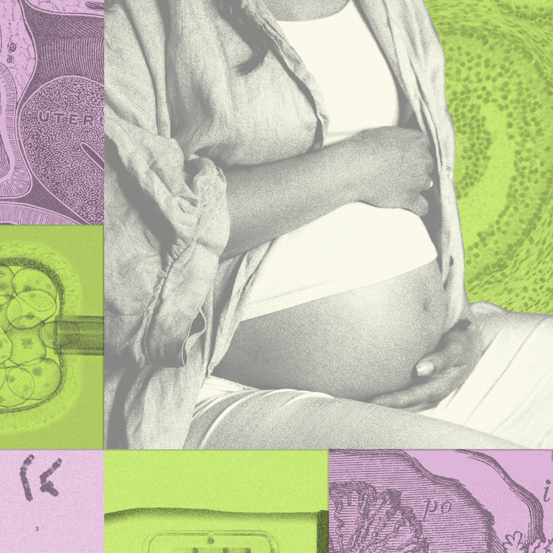 Study Questions Efficacy of IVF 'Add-On' Services